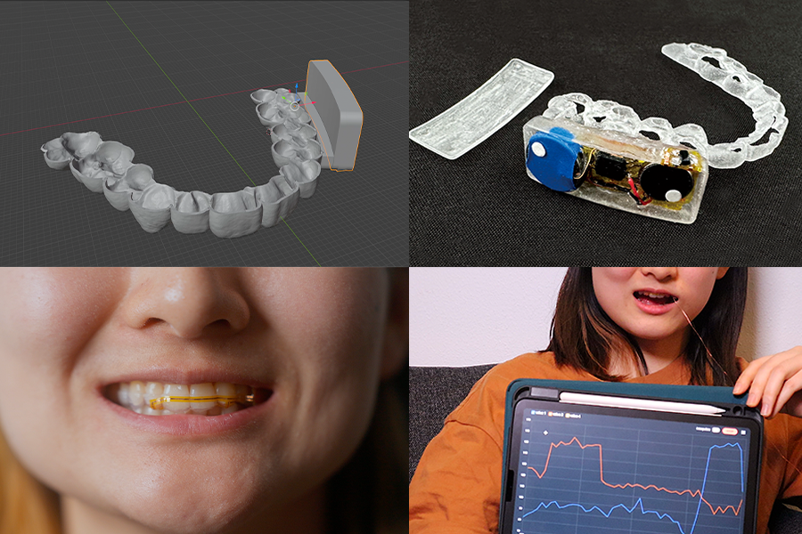 A dental brace developed by researchers at MIT CSAIL and Aarhus University can be fabricated with sensors and feedback components to capture in-mouth interactions and data (Credits: Photos courtesy of Sebastian Krog Knudsen and the researchers).