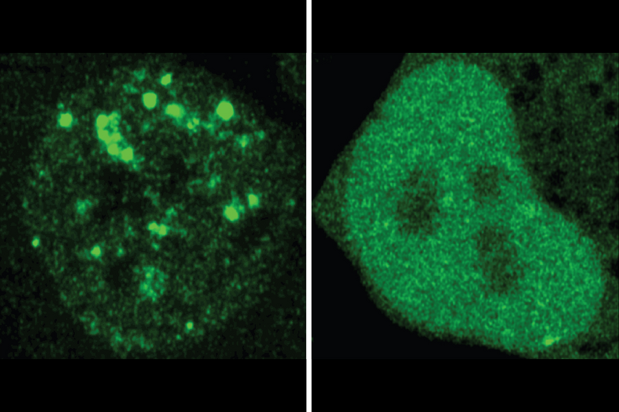 ProtGPS predicts where a protein will localize in a healthy cell (left) and in the instance of a pathogenic mutation (right). Punctate green dots represent localized proteins (Credit: Henry Kilgore and Lena Afeyan/Whitehead Institute).